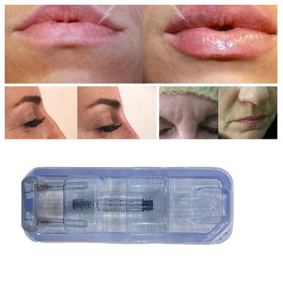 حقن حامض الهيالورونيك الحمض حشو الشفاه حقن 24mg/ ml العناية بالوجه