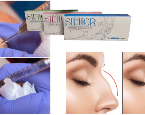 الحمض الهيالوروني الجل الجل الحامض الجل 20mg/ml متقاطع