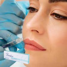 حمض الهيالورونيك المحقق ملء جل الجلد المحقق للشفتين