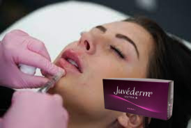 24mg/ ml Juvederm حمض الهيالورونيك حشيش الجلد حقن الوجه