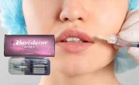 Juvederm Ultra3 حمض الهيالورونيك الحامض الجلدي المرتبط بالمرابطة HA الحامض CE GMP