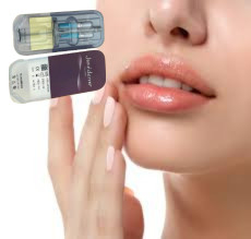 Juvederm Voluma HA حشوة جلدية قابلة للحقن للخطوط الماريونية