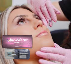 Juvederm Ultra 3 حقن حامض جلدي حمض الهيالورونيك حقن الوجه 2*1ml