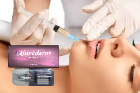 الحمض الهيالوروني المرتبط بالعبرة الحمض الهيالوروني المرتبط بالعبرة الحمض الهيالوروني Juvederm Vollure للشفاه 2*1ml