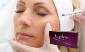 Juvederm Ultra 3 حقن حامض جلدي حمض الهيالورونيك حقن الوجه 2*1ml