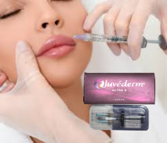 Juvederm الحمض الهيالوروني الجلدي حشوات الشفاه الحشوة الجلدية المتقاطعة حقن الشفاه