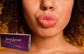 Juvederm Ultra3 2x1ml حمض الهيالورونيك حشوات الوجه الجلدية
